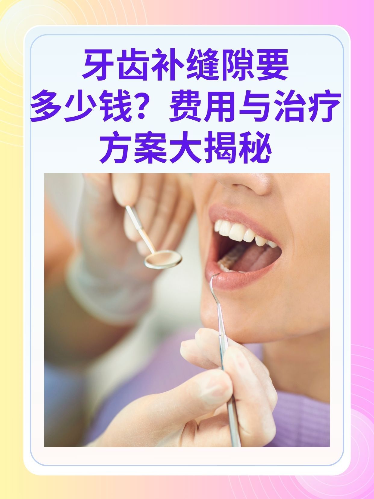 上海补牙医保可以报销吗(补牙医保可以报销吗 哪些可以报销呢)